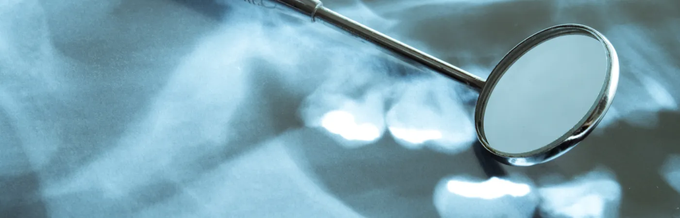 歯科医院の自費率アップを実現するアドバイスの進め方